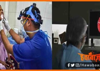 Black Fungus, Cricket Ball Jitna Bada Black Fungs, IGIMS Black Fungus, IGMS Black Fungus, Bihar news, Patna Ke Doctor ko salam, Bihar news, Bihar hindi news, Bihar lettest news, Bihar big breaking,